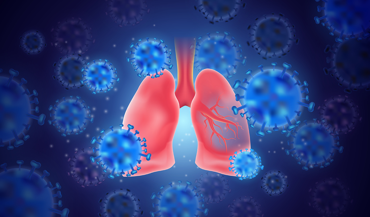 The Role of Lung Ultrasound in COVID-19 Patients (with resources)